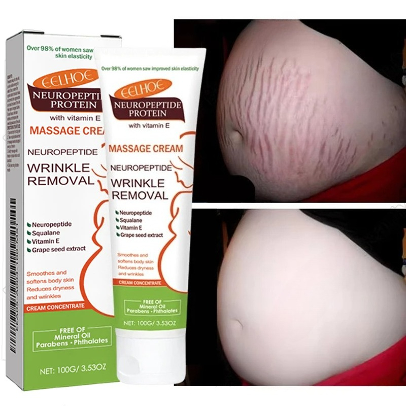 Teeth Whitening Pregnancy - 100g Çatlak İzlerini Kalıcı Olarak Giderici