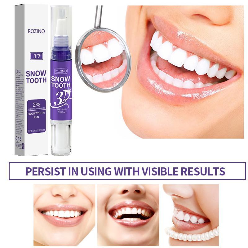 Yeni Taşınabilir Diş Beyazlatm - Whitening Pen Bleach incelemesi ve fiyatı