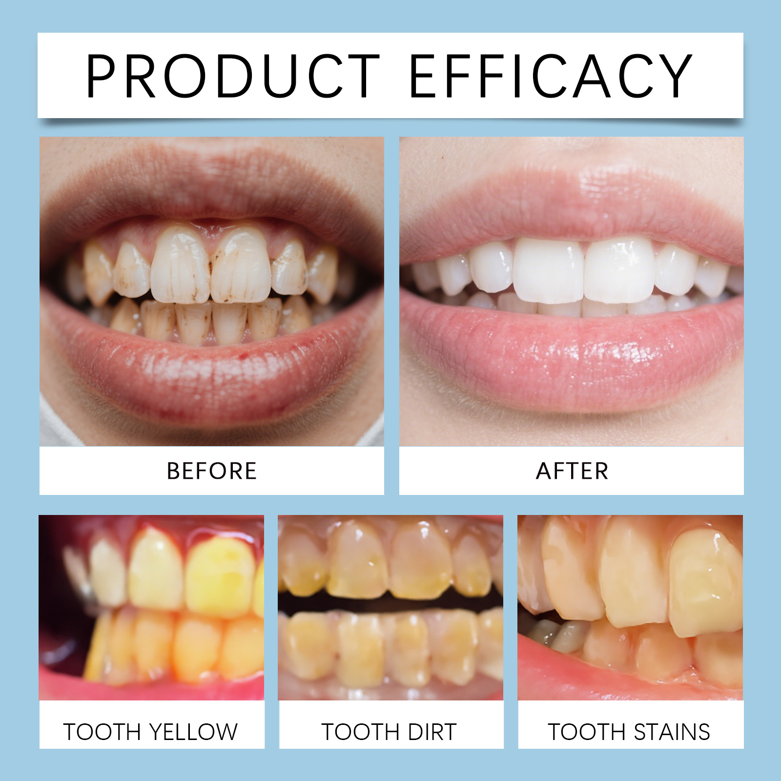 Feimuko 8ml Diş Jeli Kalemi Na - Teeth Whitening Pens incelemesi ve fiyatı