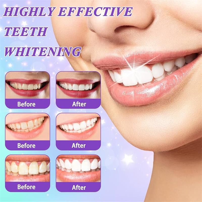 9D Mor Diş Beyazlatıcı Diş Mac - Teeth Whitening Natural incelemesi ve fiyatı