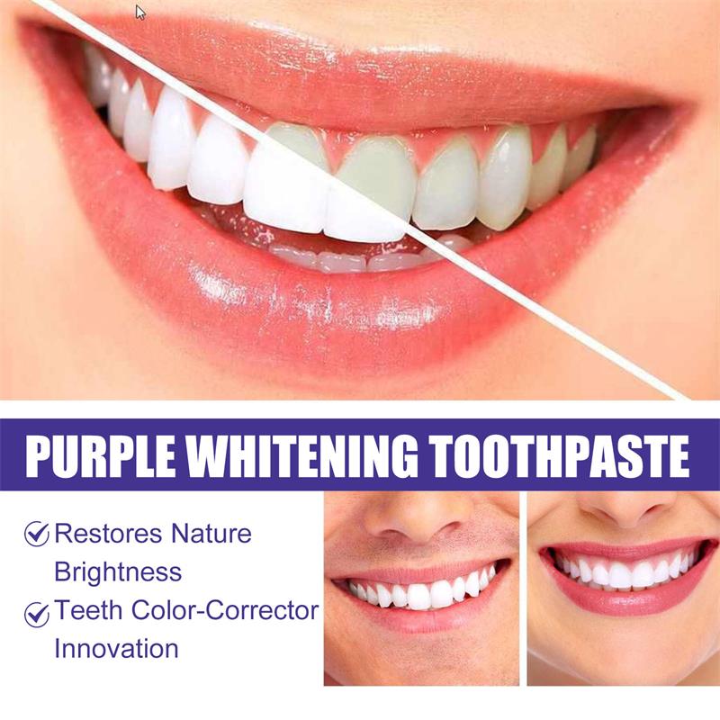 9D Mor Diş Beyazlatıcı Diş Mac - Teeth Whitening Natural incelemesi ve fiyatı