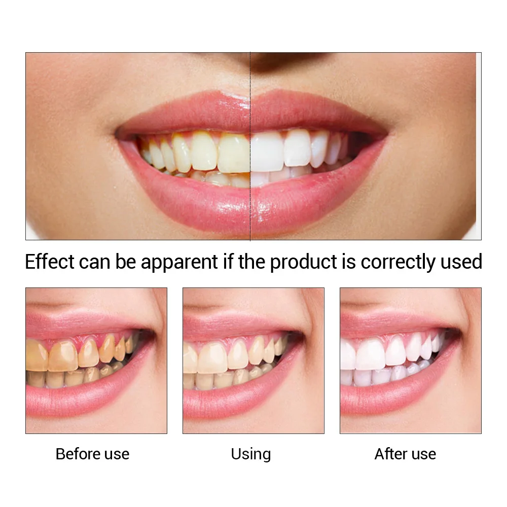 FTEENPLY diş beyazlatma özü to - Teeth Whitening Natural incelemesi ve fiyatı