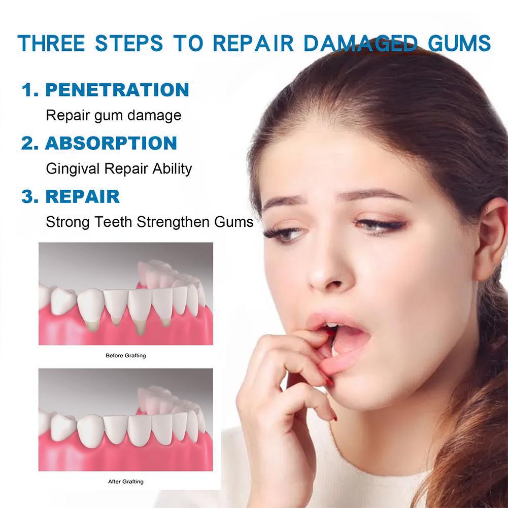 Diğer Diğer Diş Bakım Ürünleri - Teeth Whitening Natural incelemesi ve fiyatı