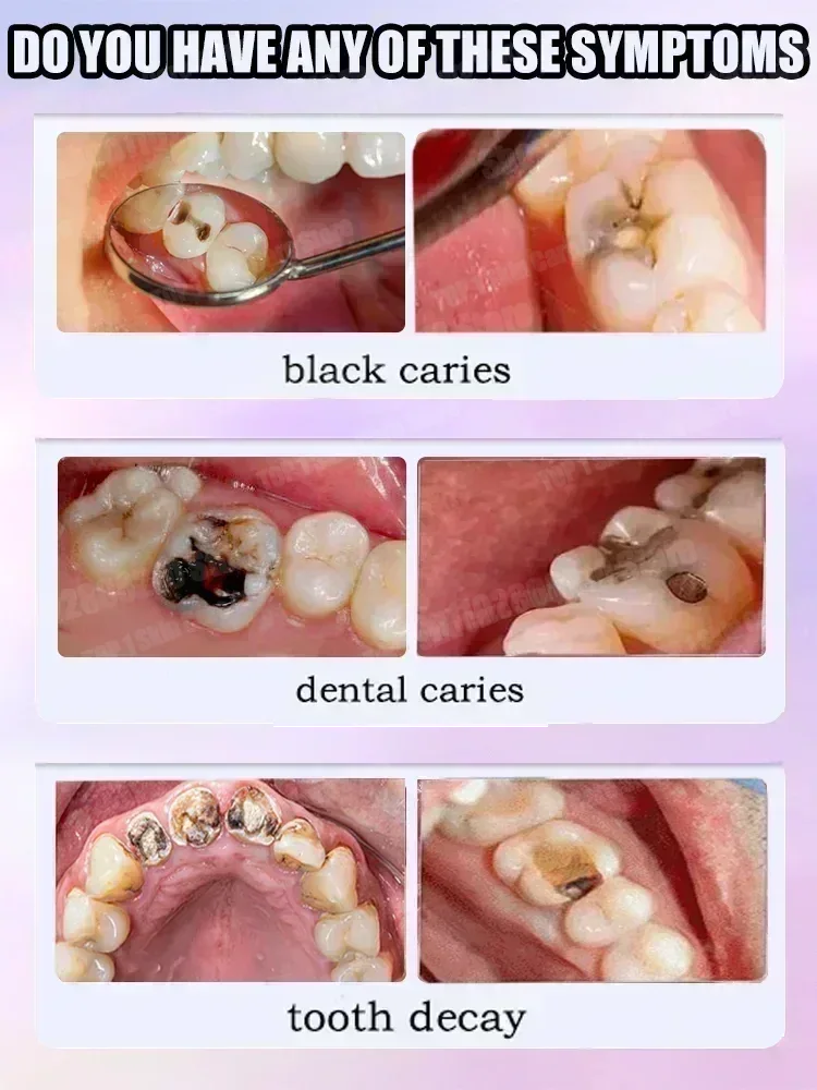 Sıcak satışlar En çok satan, B - Teeth Whitening Gum incelemesi ve fiyatı
