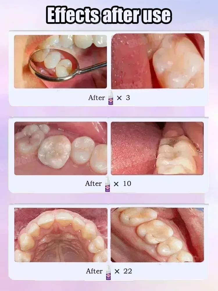 Diğer Diş Temizleme Ürünleri D - Teeth Whitening Gum incelemesi ve fiyatı